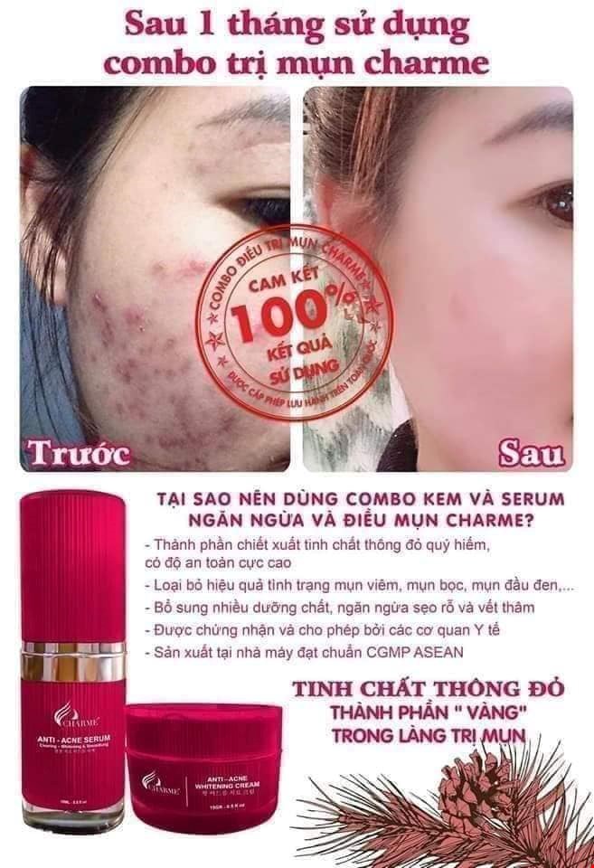 Combo Trị Mụn Charme Thông Đỏ Hàn Quốc